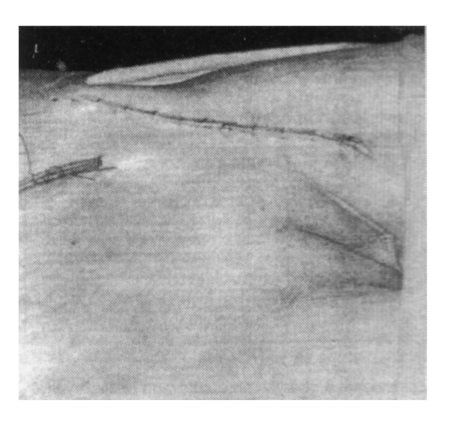 Ryc. 2
