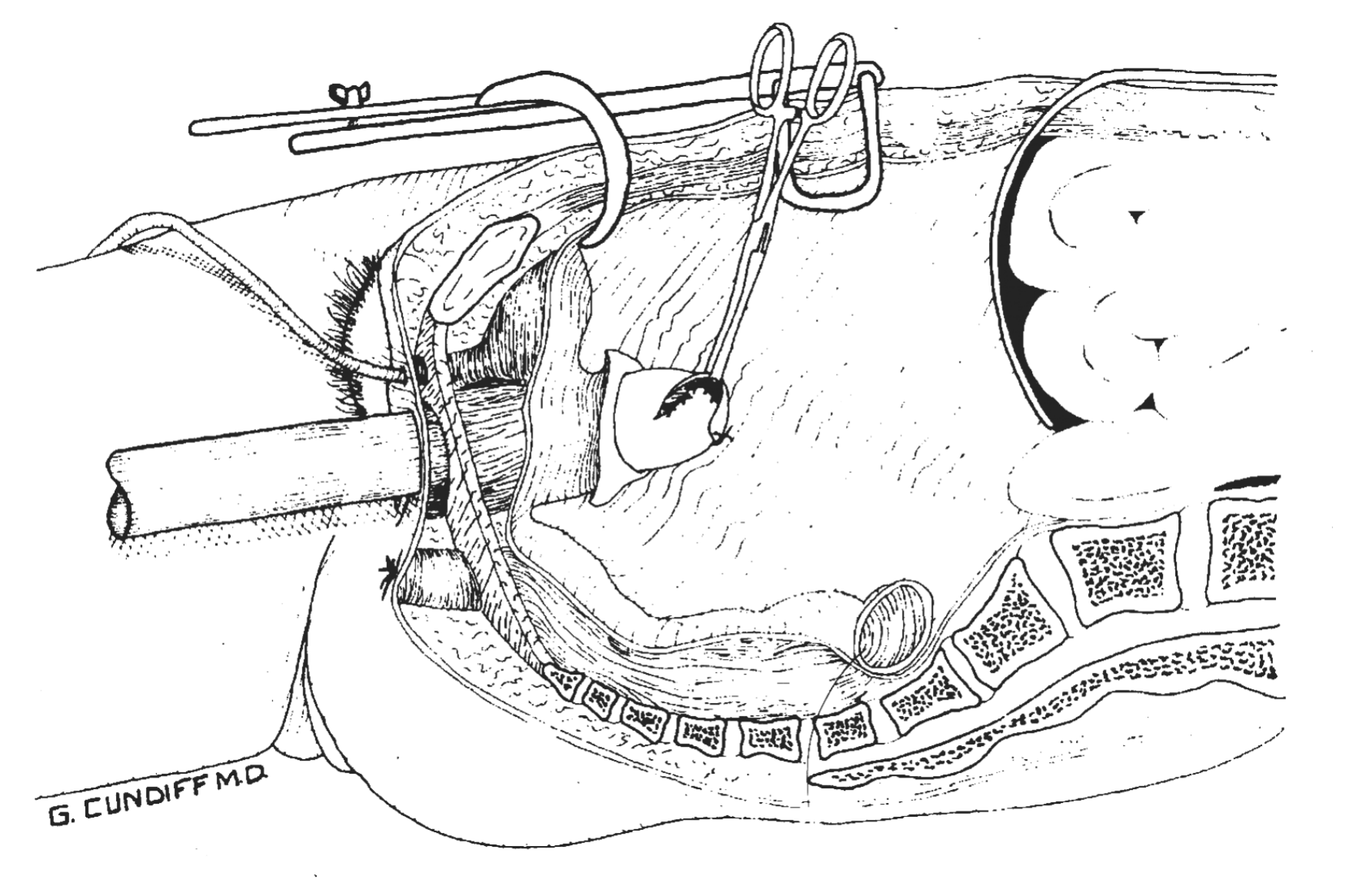 Ryc. 1