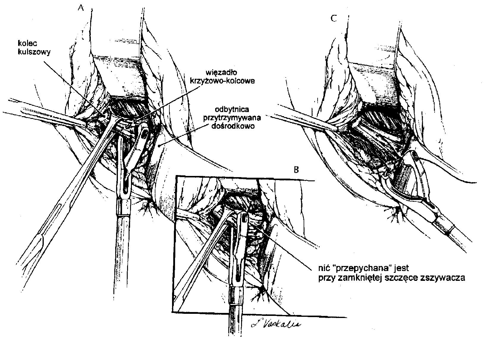 Ryc. 4