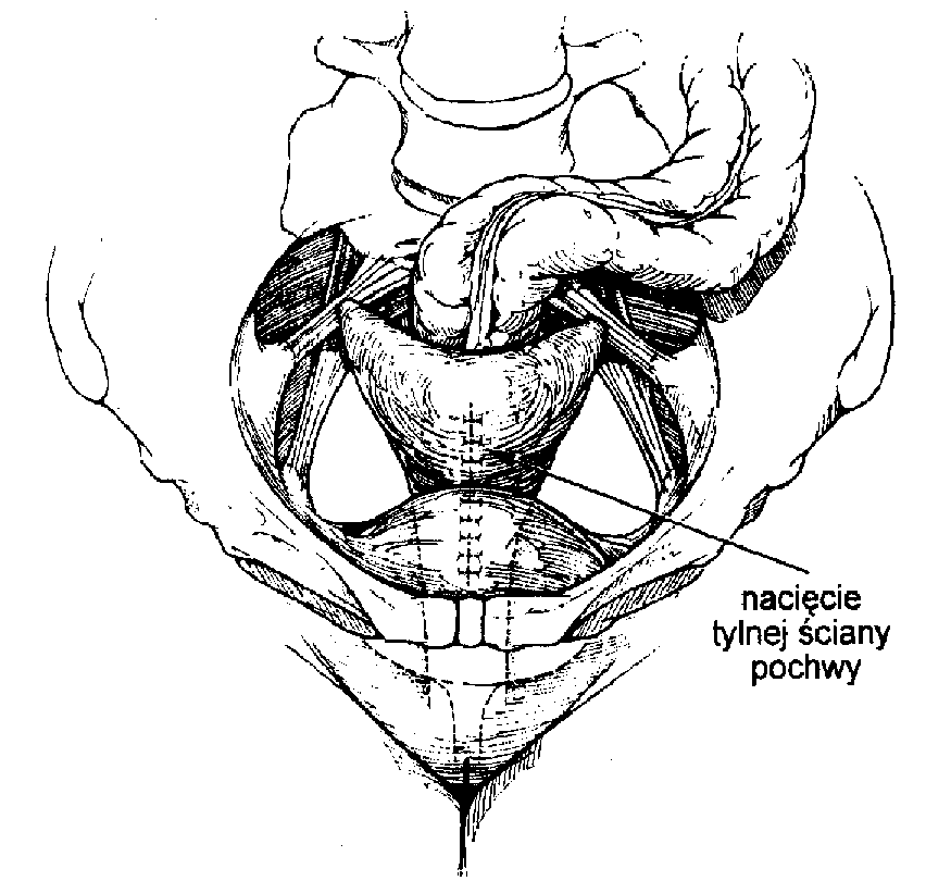 Ryc. 5