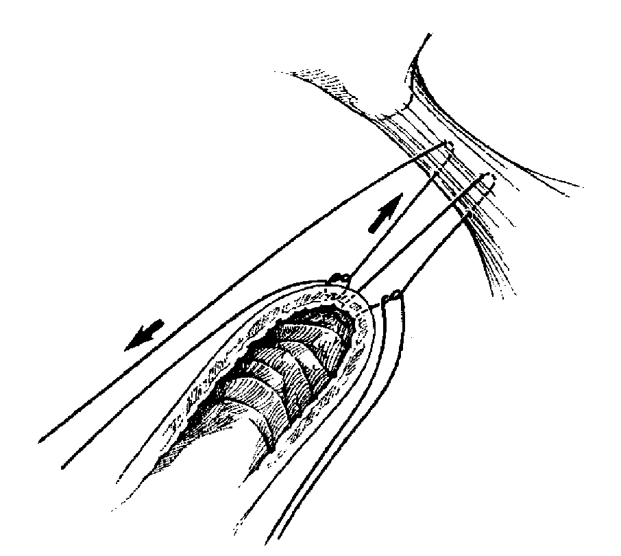 Ryc. 6