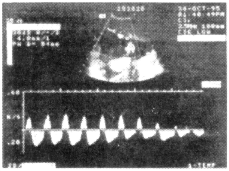 Ryc. 2