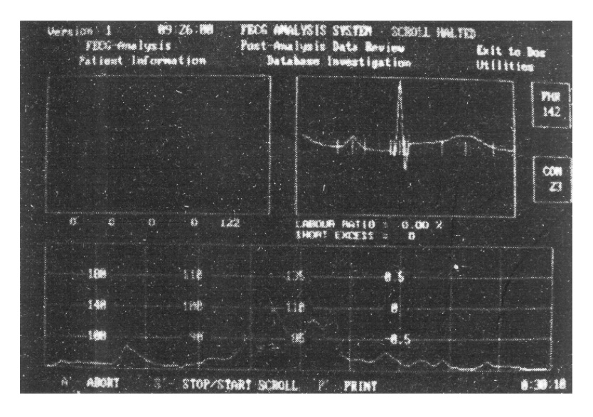 Ryc. 3