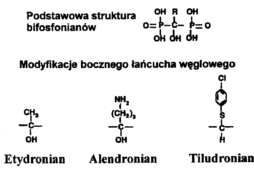  Ryc. 1. Podstawowa struktura bifosfonianów i najczęstsze jej warianty 