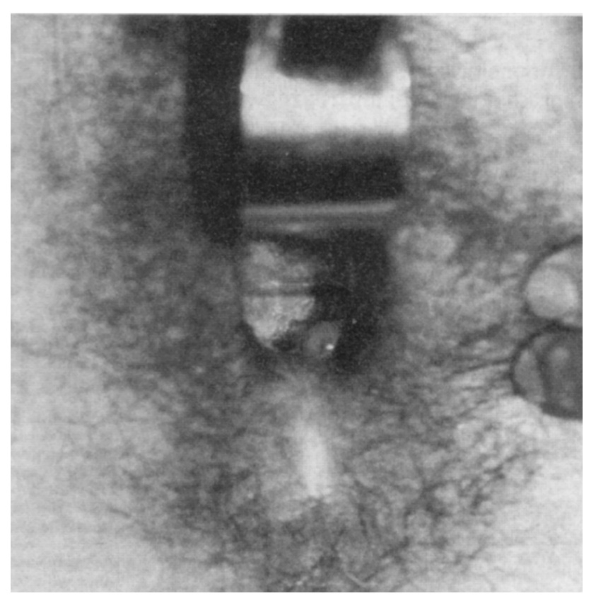 Ryc. 6