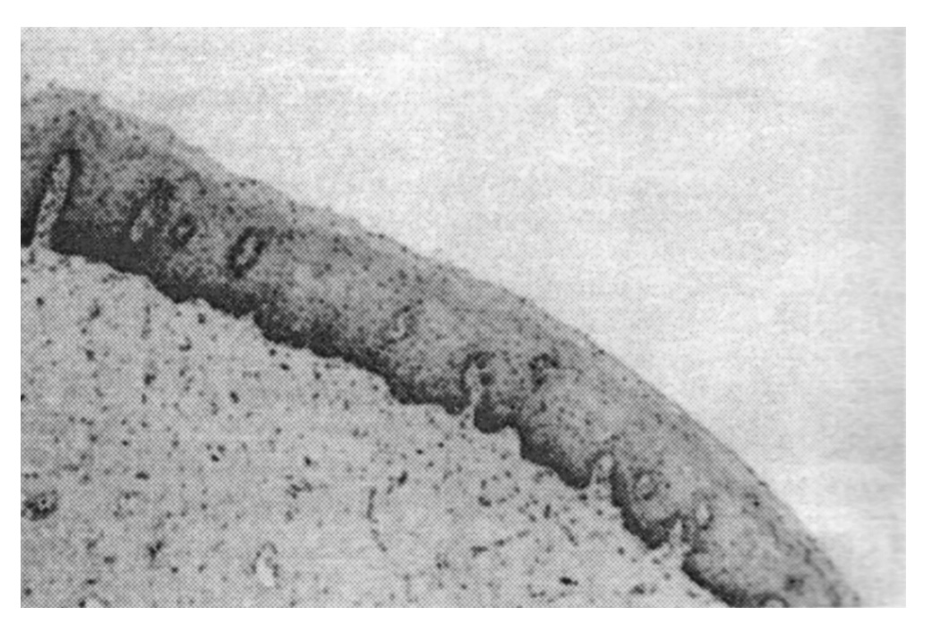  Ryc. 1. Preparat histologiczny zdrowej skóry sromu 