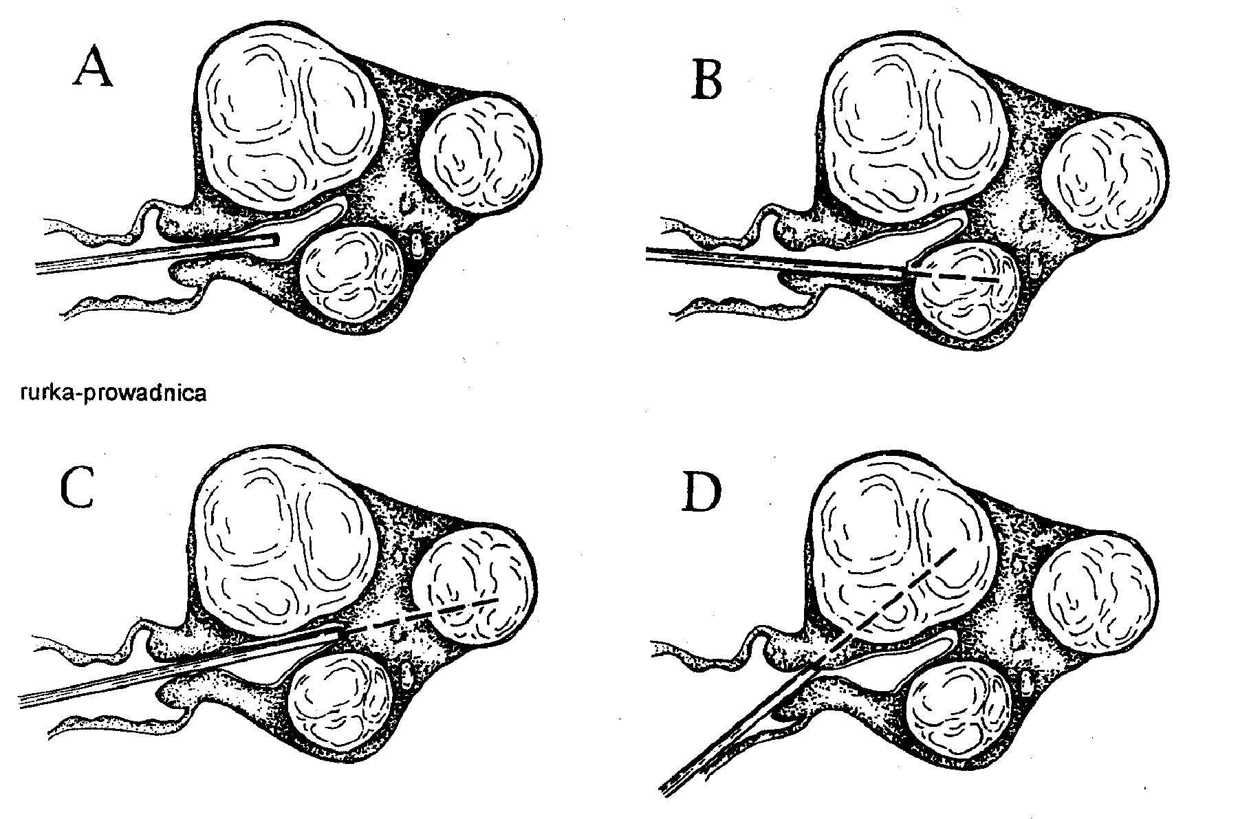 Ryc. 2