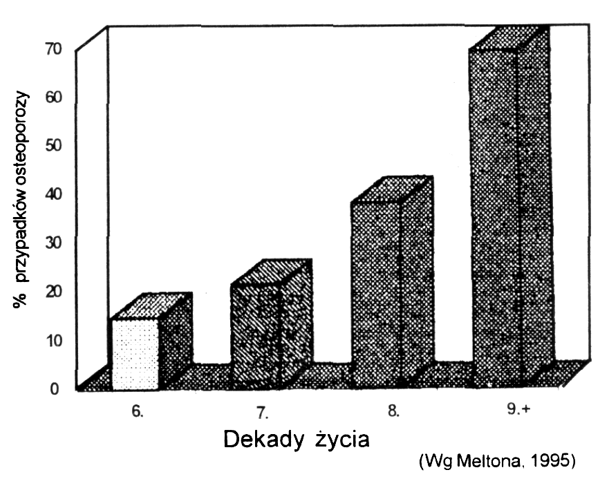  Ryc. 1. Częstość występowania osteoporozy u kobiet (wg. kryteriów WHO) 