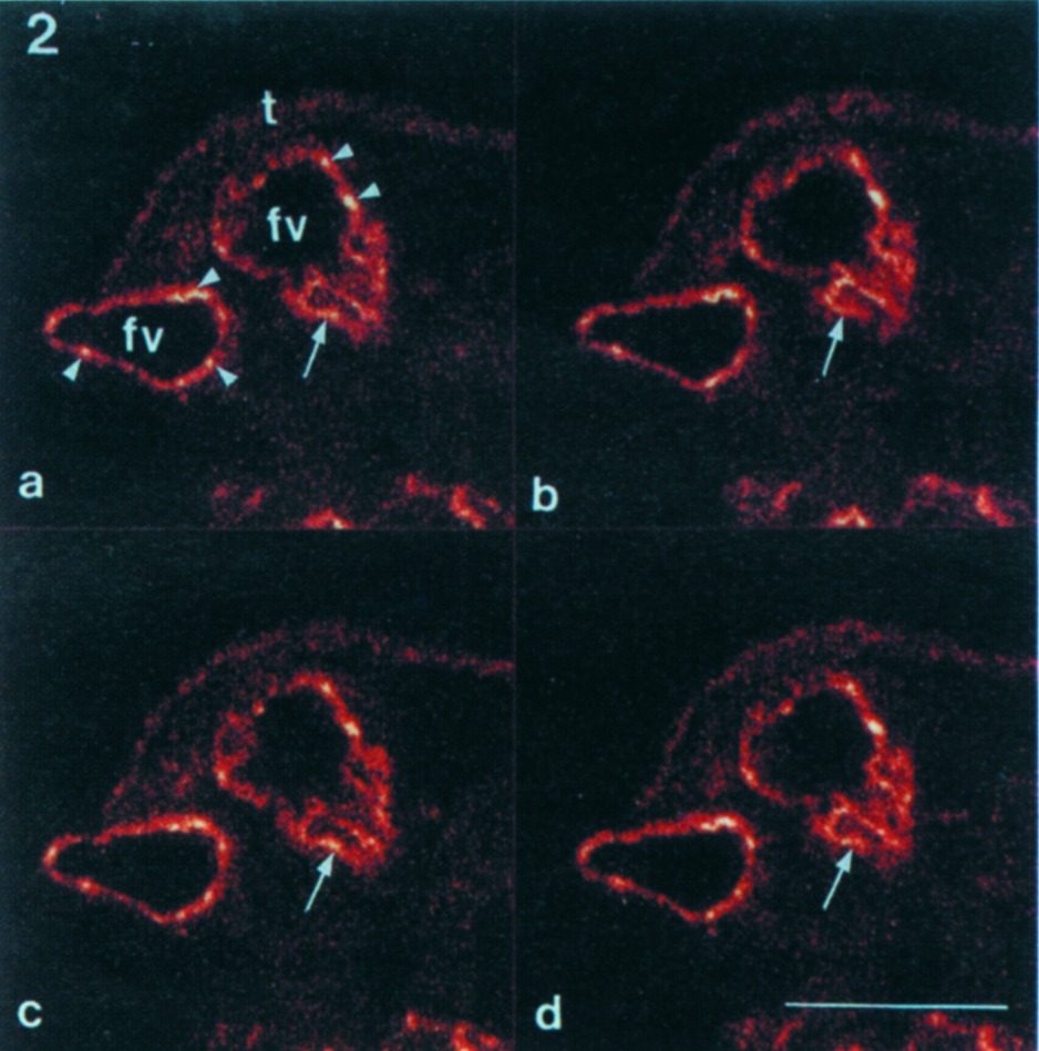  Ryc. 2. Obraz z mikroskopu współogniskowego (confocal microscopy). Rejestracja mikronaczyń płodowych łożyska w ciąży do