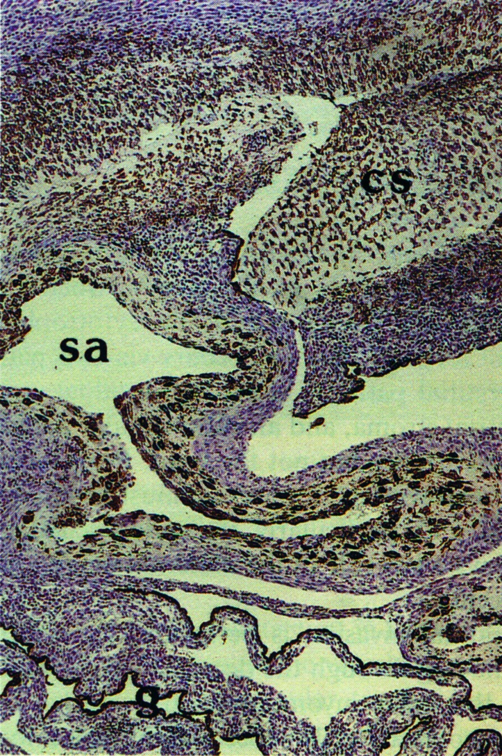  Ryc.1. Łożysko pawiana z immunohistochemicznym znakowaniem na obecność cytokeratyny jako markera trofoblastu, pokazując
