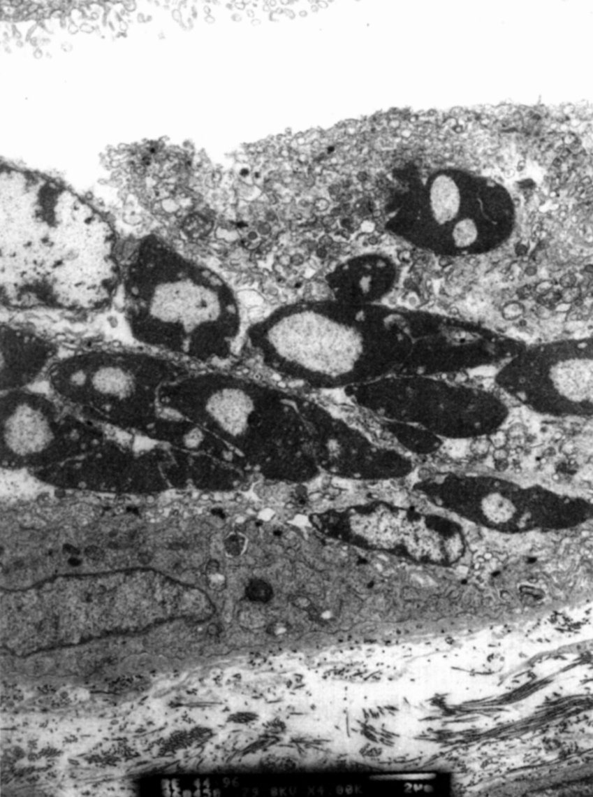 Ryc. 3. Molekularny mechanizm apoptozy