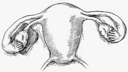 Ryc. 2
