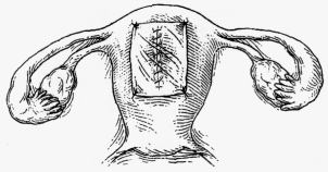 Ryc. 4