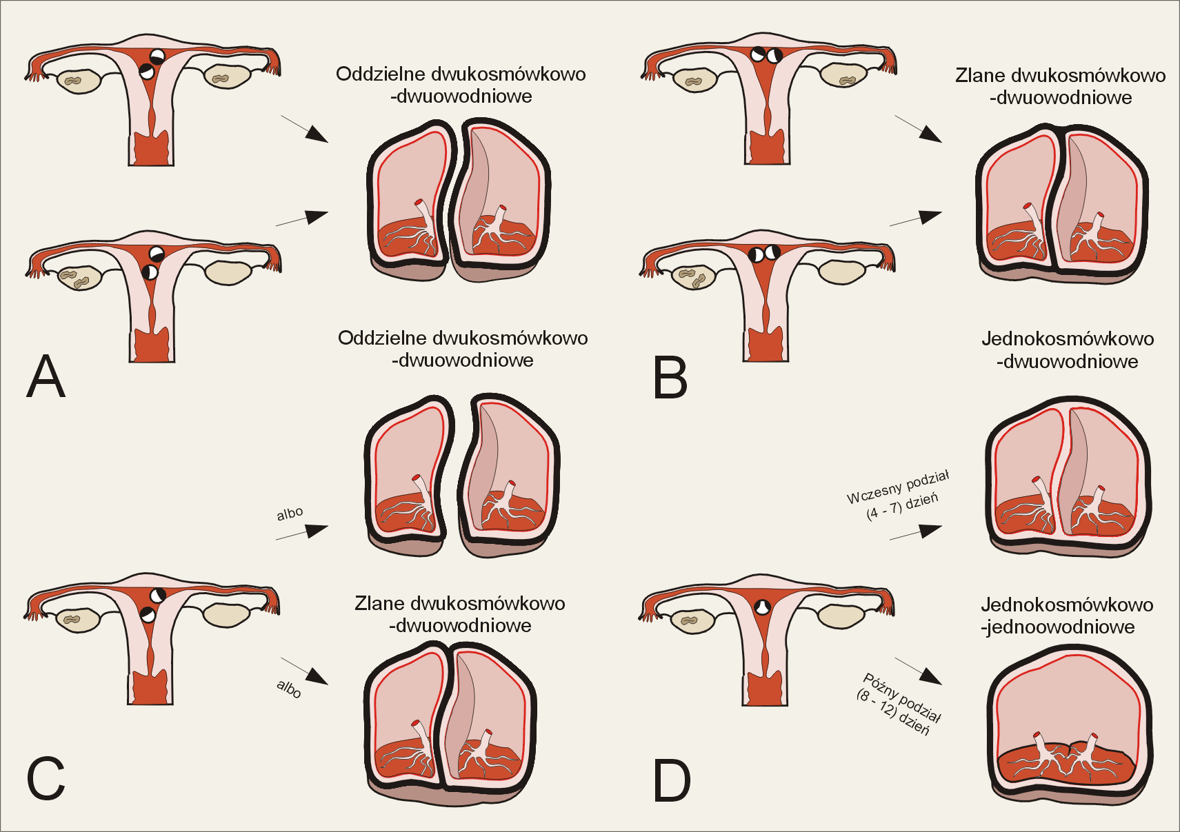 Ryc. 1. (A) dwa ciałka żółte, dwie komórki jajowe, oddzielna implantacja; (B) dwa ciałka żółte, dwie komórki jajowe, ad