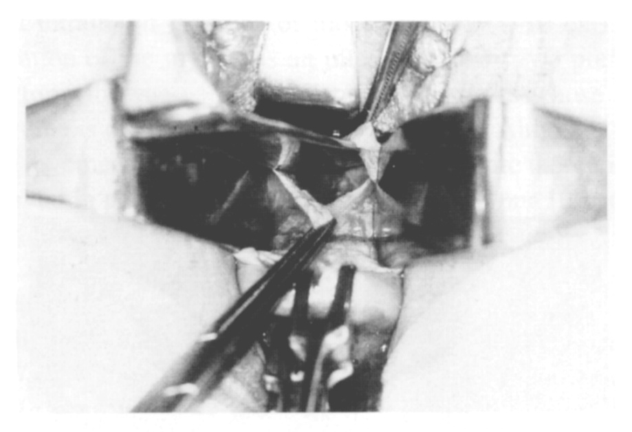 Ryc. 4