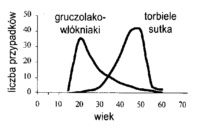  Ryc. 1 Struktura wiekowa pacjentek z gruczolakowłókniakami i torbielami sutka 