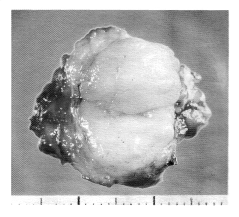 Ryc. 2