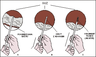 Ryc. 14