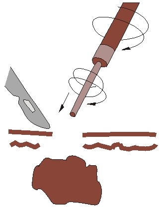 Ryc. 15