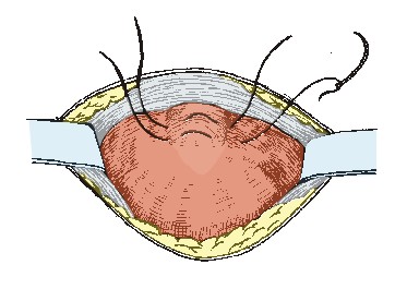 Ryc. 1