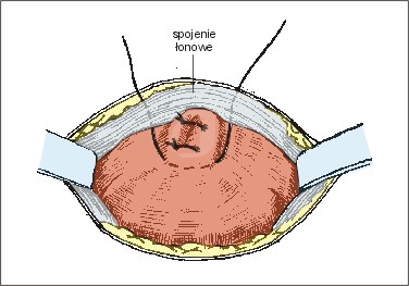Ryc. 2