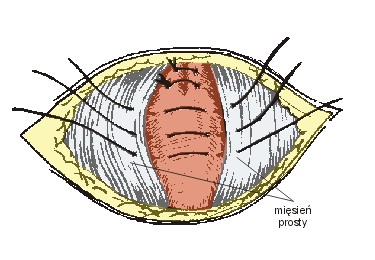 Ryc. 3