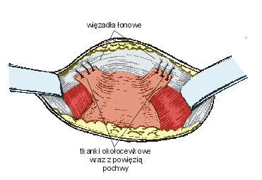 Ryc. 4