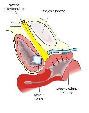 Ryc. 5