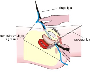 Ryc. 7
