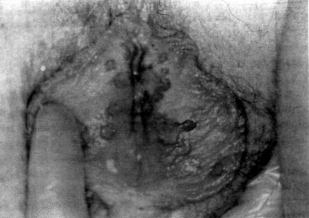 Ryc. 2