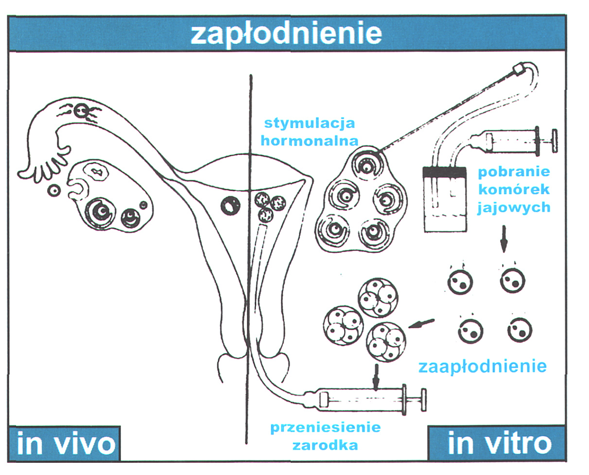  Ryc. 3. Nieprawidłowa (triploidalna) zapłodniona komórka jajowa. Widoczne są trzy przedjądrza. Każde przedjądrze zawier