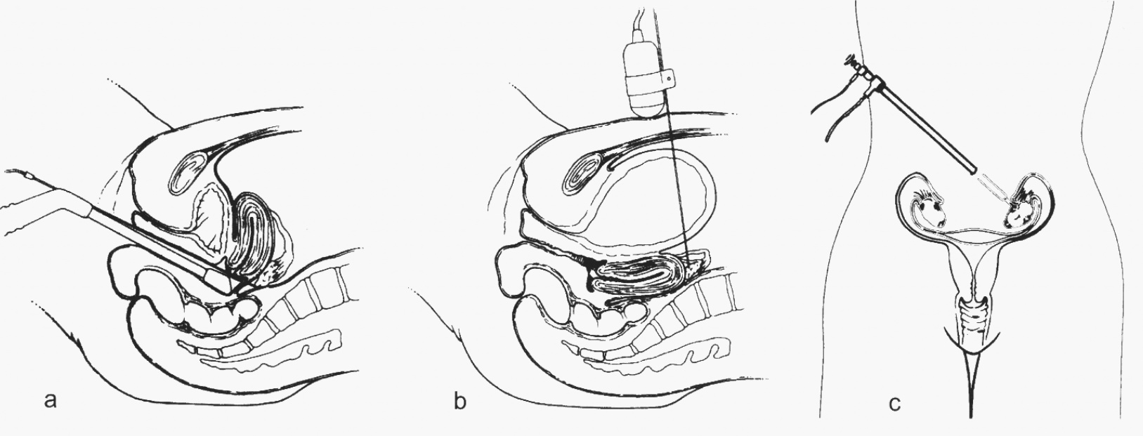 Ryc. 6