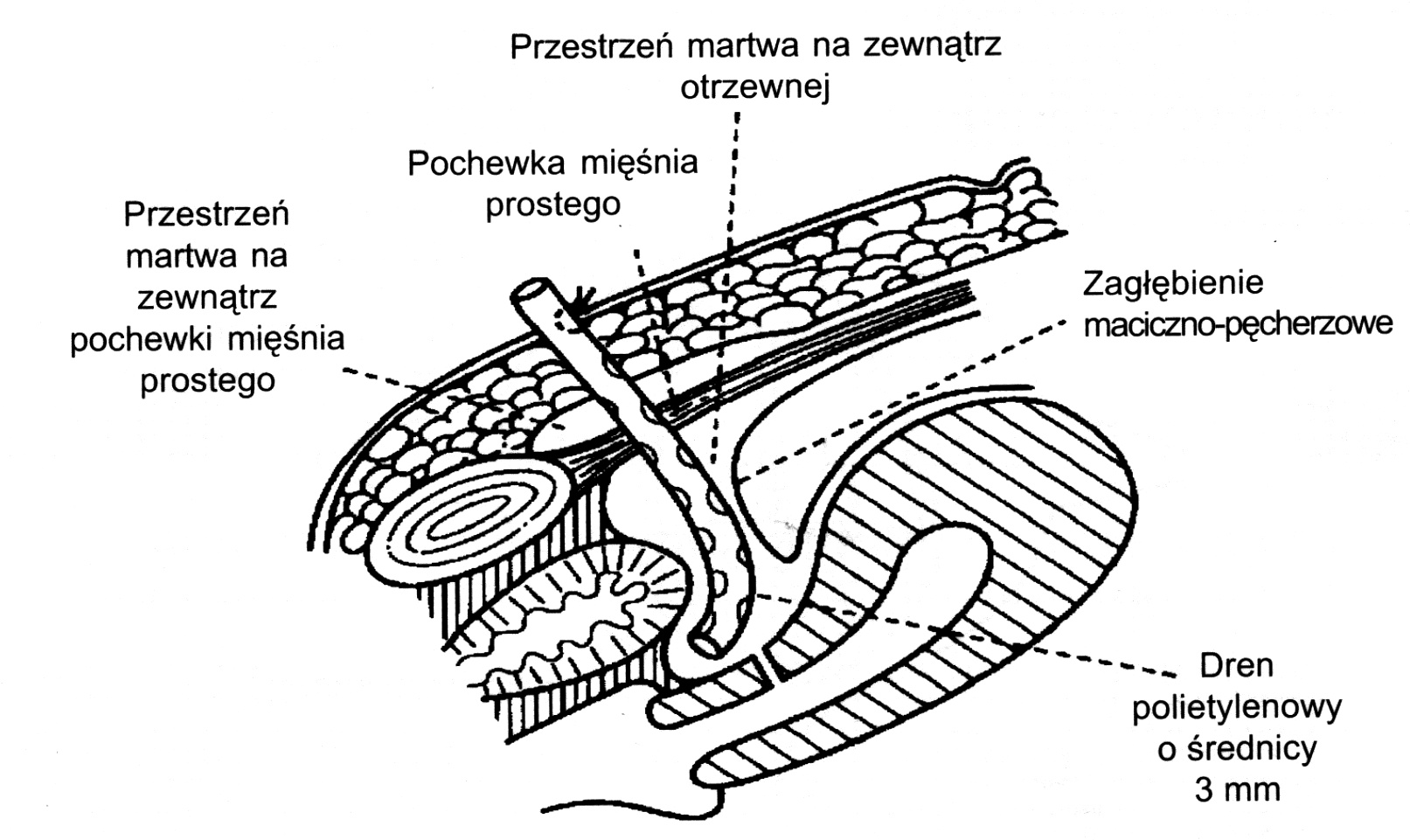  Ryc. 7. Lokalizacja drenu. Uwaga! Ilustracja przedstawia przesadnie powiększony dren 